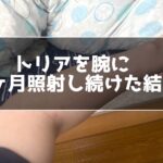 トリアを腕に一ヶ月照射し続けた結果