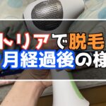 トリアで脱毛 8ヶ月経過後の様子